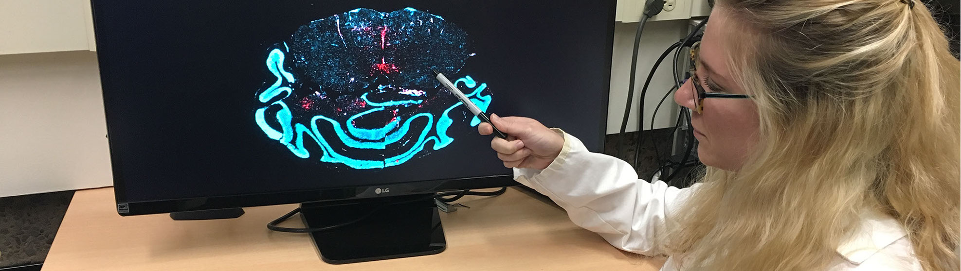 MEDSCHOOL, MIC, Research, Schaefer Lab